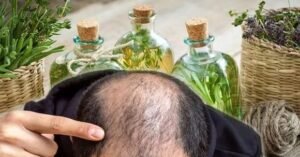 How to make rosemary oil for hair growth at home