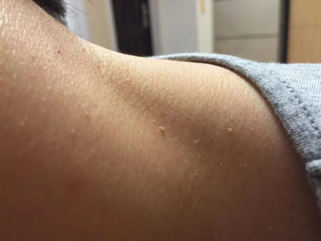 What are the "little meat particles" on the neck and armpits