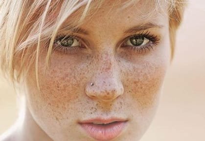 How to remove freckles naturally permanently at home