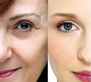 How to choose a facelift, How does facelift actually work, How to choose between large incision facelifts and small incision facelifts